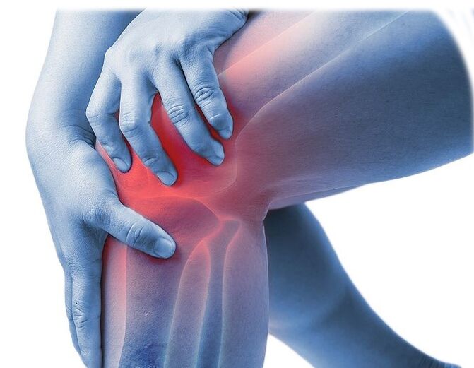 Joint pain and stiffness. 