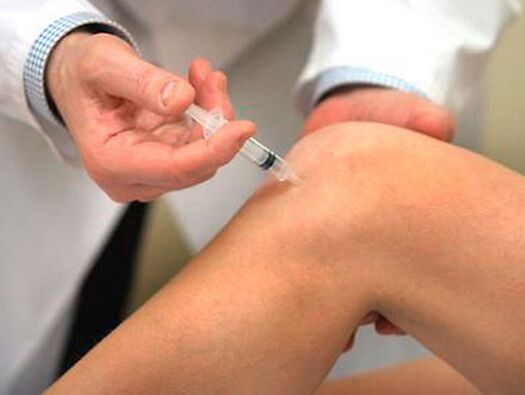 Arthrose treatment