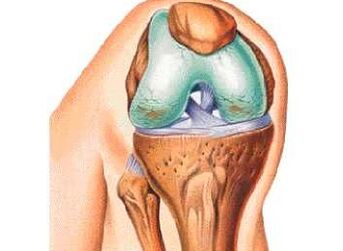 The main causes of knee osteoarthritis