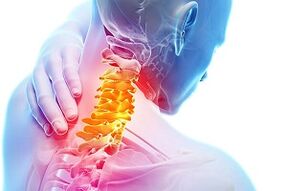 Cervical osteochondrosis symptoms and nutrition rules for disease
