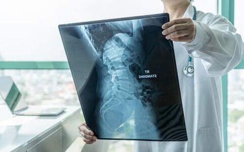 Radiography is a necessary diagnostic method if your back hurts. 